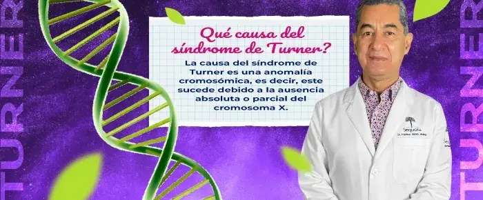 La causa del síndrome d4e Turner es una anomalía cromosómica.
