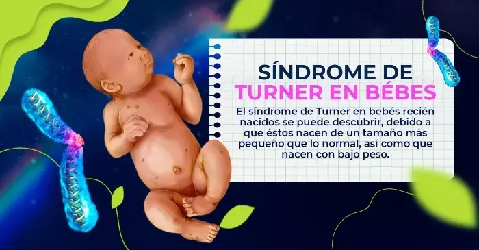 En el nacimiento del síndrome de Turner se descubren los primero síntomas