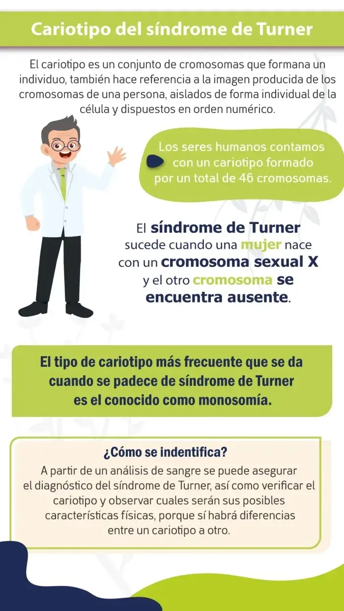 El cariotipo del síndrome de Turner más frecuente se conoce como monosomía.