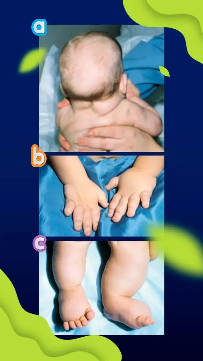 Características físicas del recién nacido -canalSALUD