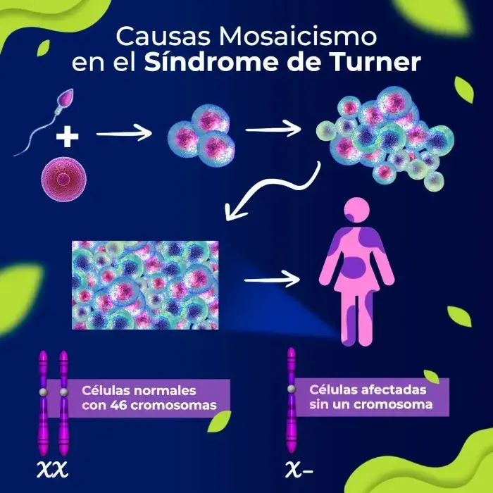 El mosaicismo es una causa del síndrome de Turner.