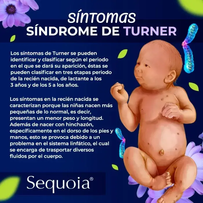 Los síntomas del síndrome de Turner en niñas recién nacidas son presentar menor peso y longitud.