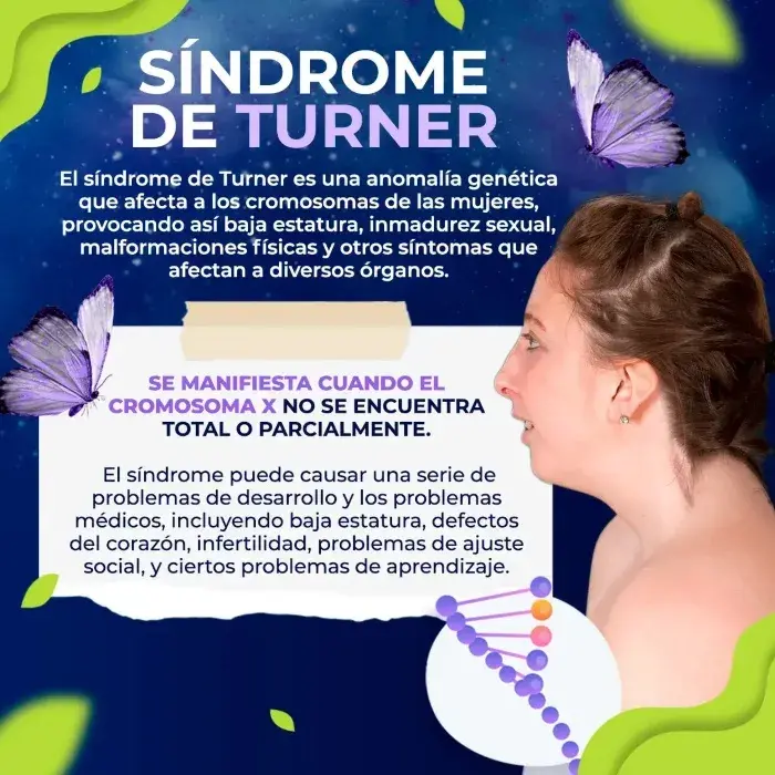 El síndrome de Turner es una anomalía genética que afecta al cromosoma X.